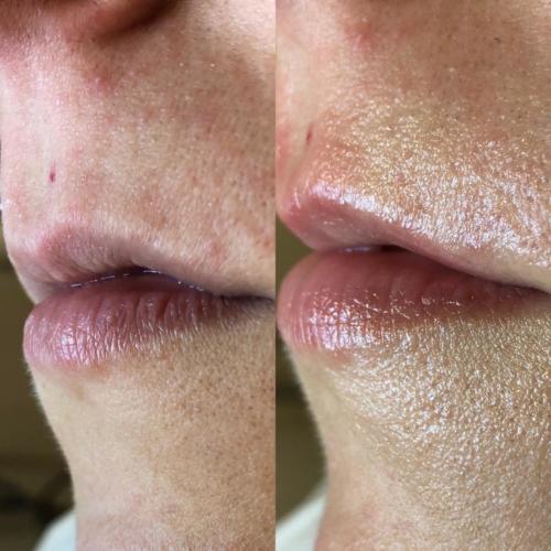 labios 01