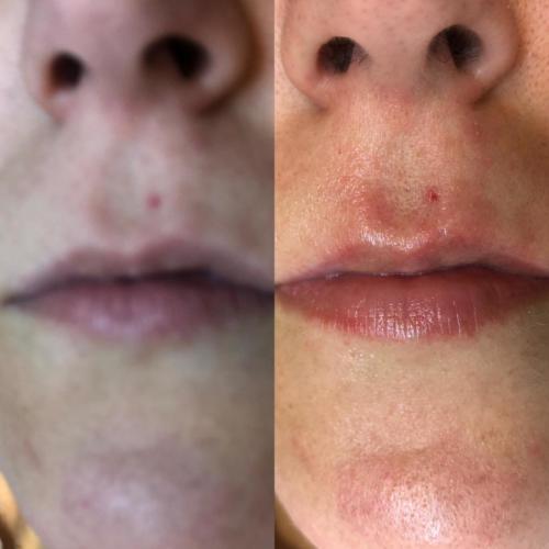 labios 02