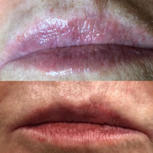 labios 03
