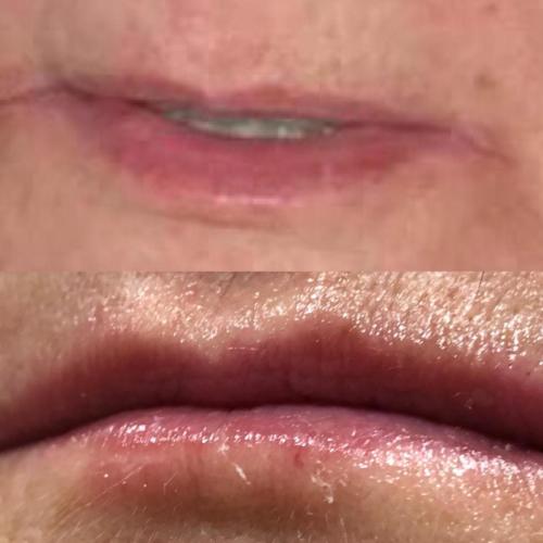 labios 04