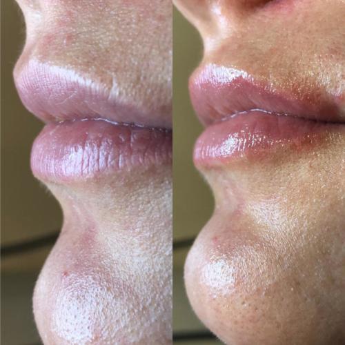 labios 05