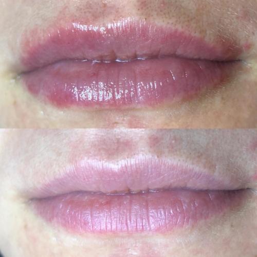 labios 06